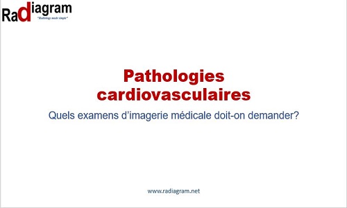 Pathologies Cardiovasculaires