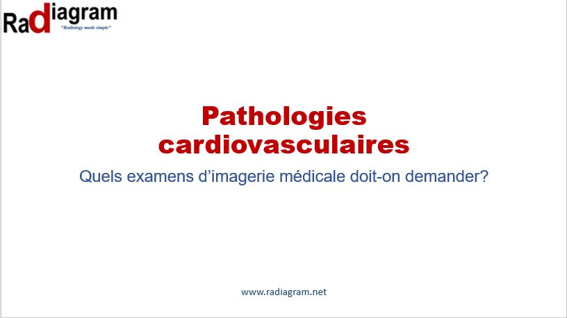 301 Indications d'imagerie en pathologies cardiovasculaires