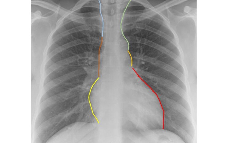  Reconnaître les arcs cardiaques en radiographie