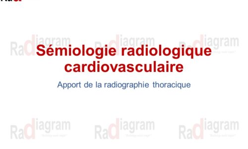 Radiographie du Cœur et des Vaisseaux