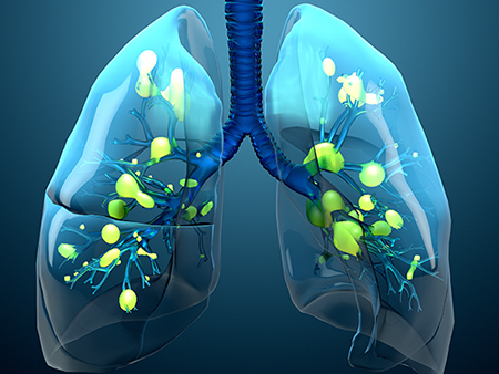  Acute respiratory illness : which imaging exam should you ask?
